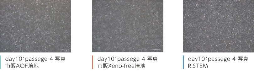 day10：passege 4 写真　市販AOF培地　day10：passege 4 写真　市販Xeno-free培地　day10：passege 4 写真　R:STEM