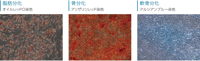 脂肪分化　骨分化　軟骨分化