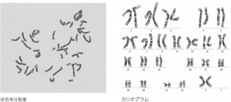 染色体分裂像　カリオグラム
