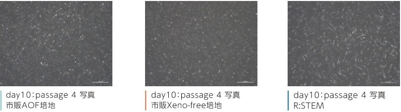 day10：passage 4 写真　競合A(市販AOF培地)　day10：passage 4 写真　競合B(市販Xeno-free培地)　day10：passage 4 写真　R:STEM