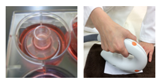 三次元培養皮膚／IPL照射機